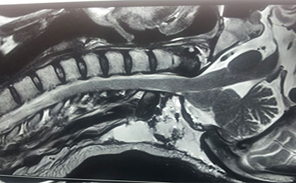 post op ar ch 2