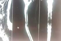 Post OP Clinical