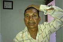 transcranial csf leak repair