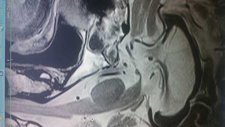 Endoscopic Surgery