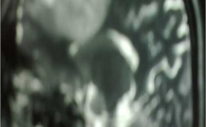 Gliomas of Brain