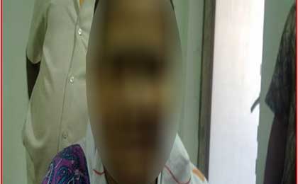 Intracerebral Haematoma